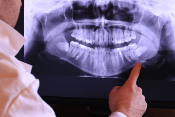 Best Emergency Root Canal Treatment in South Chicago Heights, IL