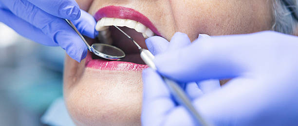 Best Broken or Cracked Tooth Emergency Dentist in South Chicago Heights, IL